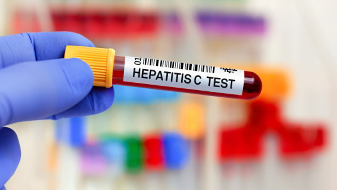 hepatita