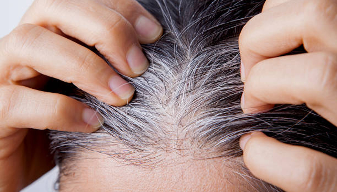 Young woman with white hair problem