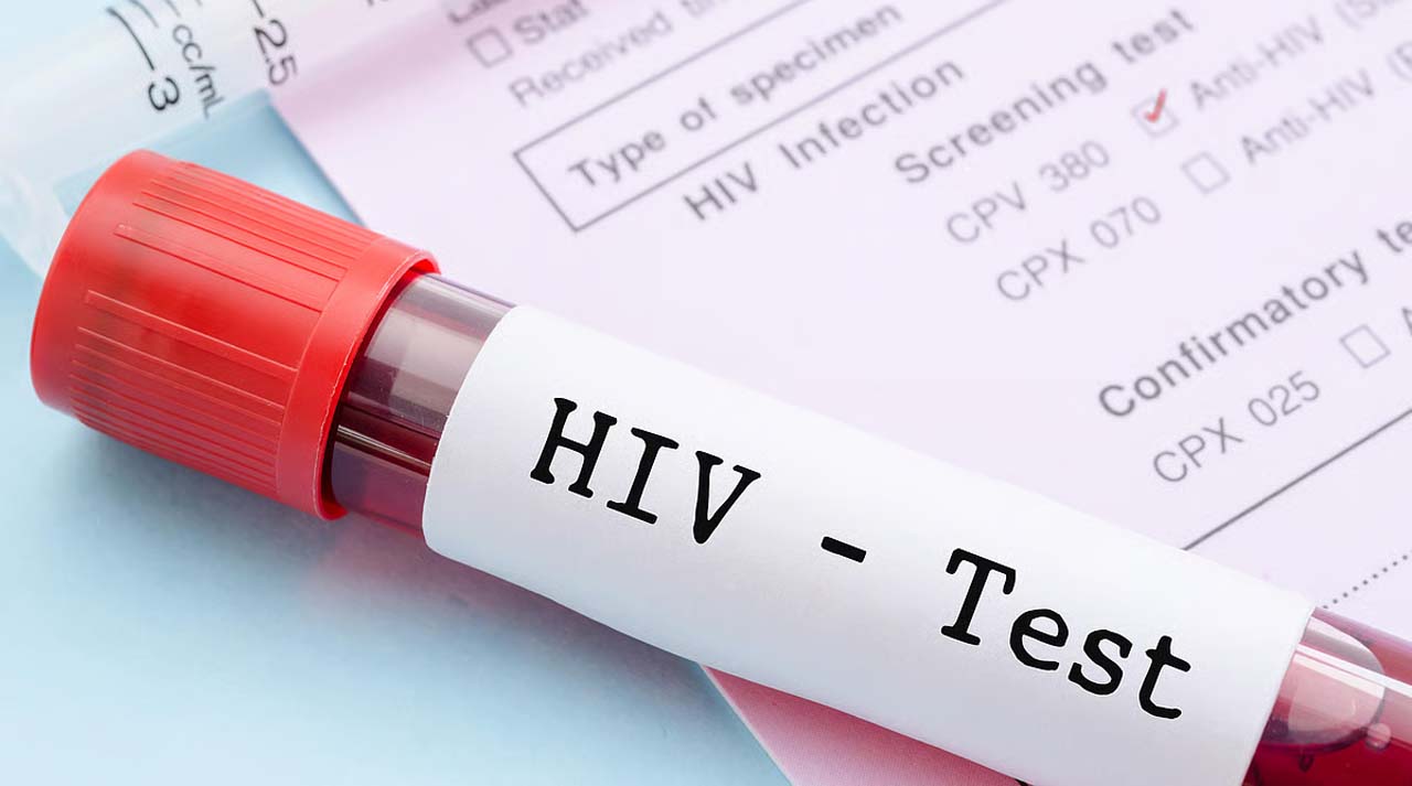 hiv